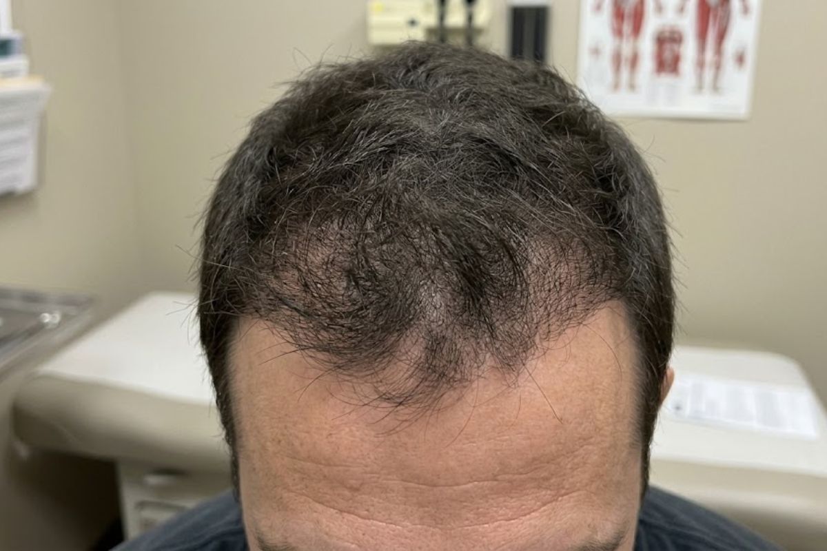 After treatment